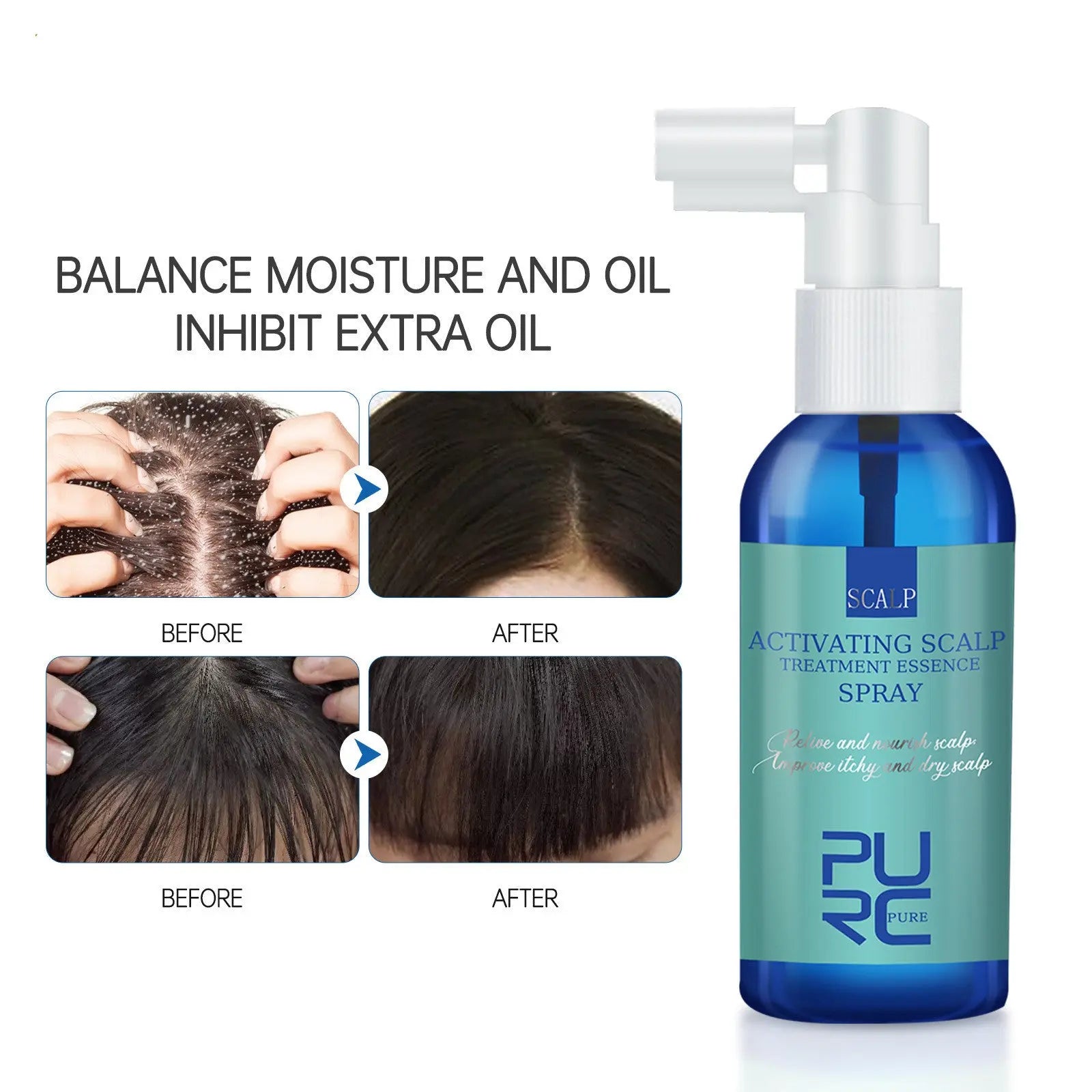 Scalp Care Serum Anti-dandruff Refreshing And Strengthening Mist Louisiana Mart