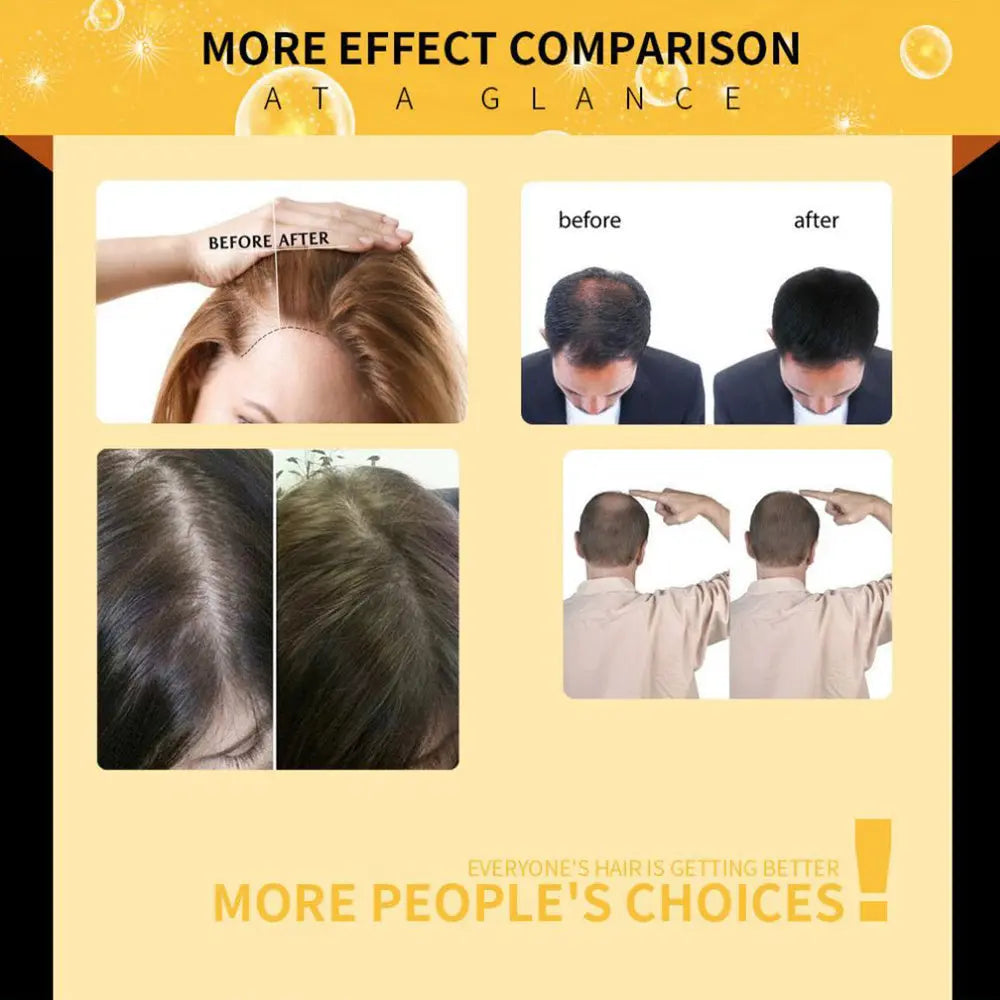 Damaged Hair Repair Women Men's Fast Hair Growth Essence Oil Anti-hair Loss Lotion Louisiana Mart