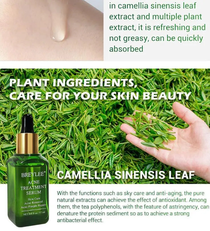 Acne Treatment Serum Facial Repair Oil Louisiana Mart