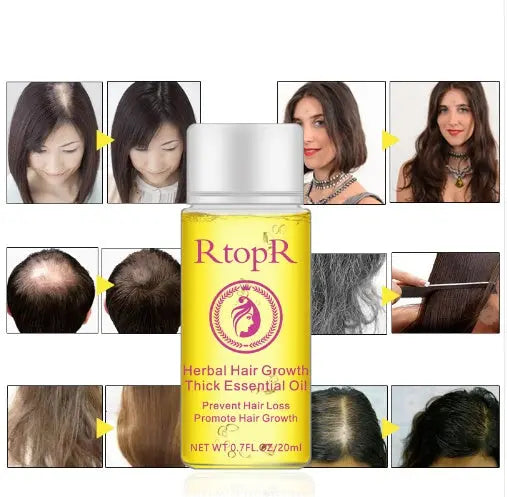 Fast Powerful Hair Growth Products Essential Oil Liquid Treatment Preventing Hair Loss Hair Care 20ml Louisiana Mart