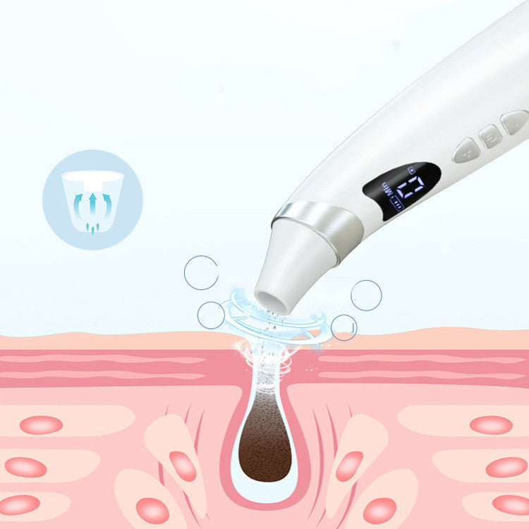 Electric Visual Blackhead Suction Instrument Household Cleansing Pore Cleaner For Skin Equipment Skin Care Tool Louisiana Mart