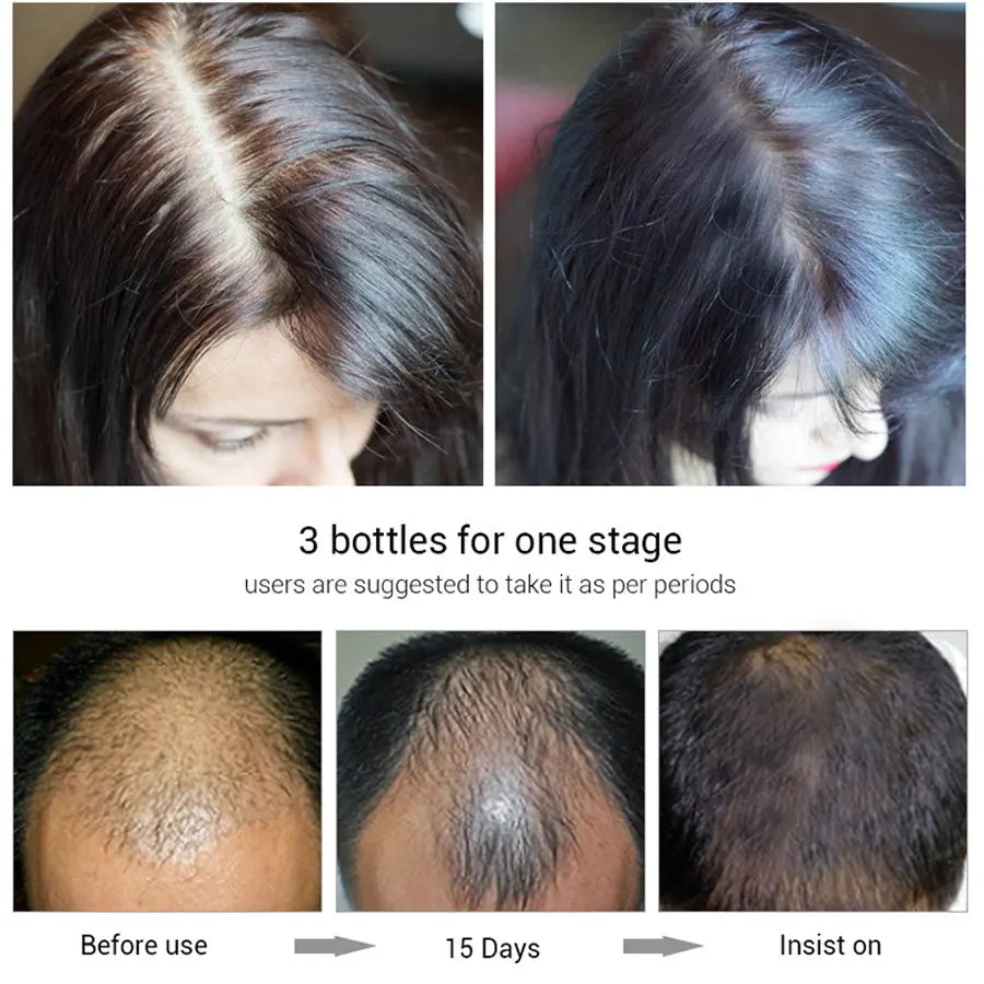 Efero Herbal hair growth fluid Louisiana Mart