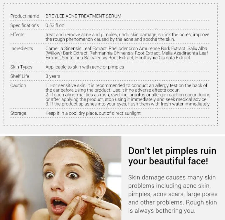 Acne Treatment Serum Facial Repair Oil Louisiana Mart