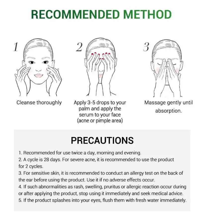Acne Treatment Serum Facial Repair Oil Louisiana Mart
