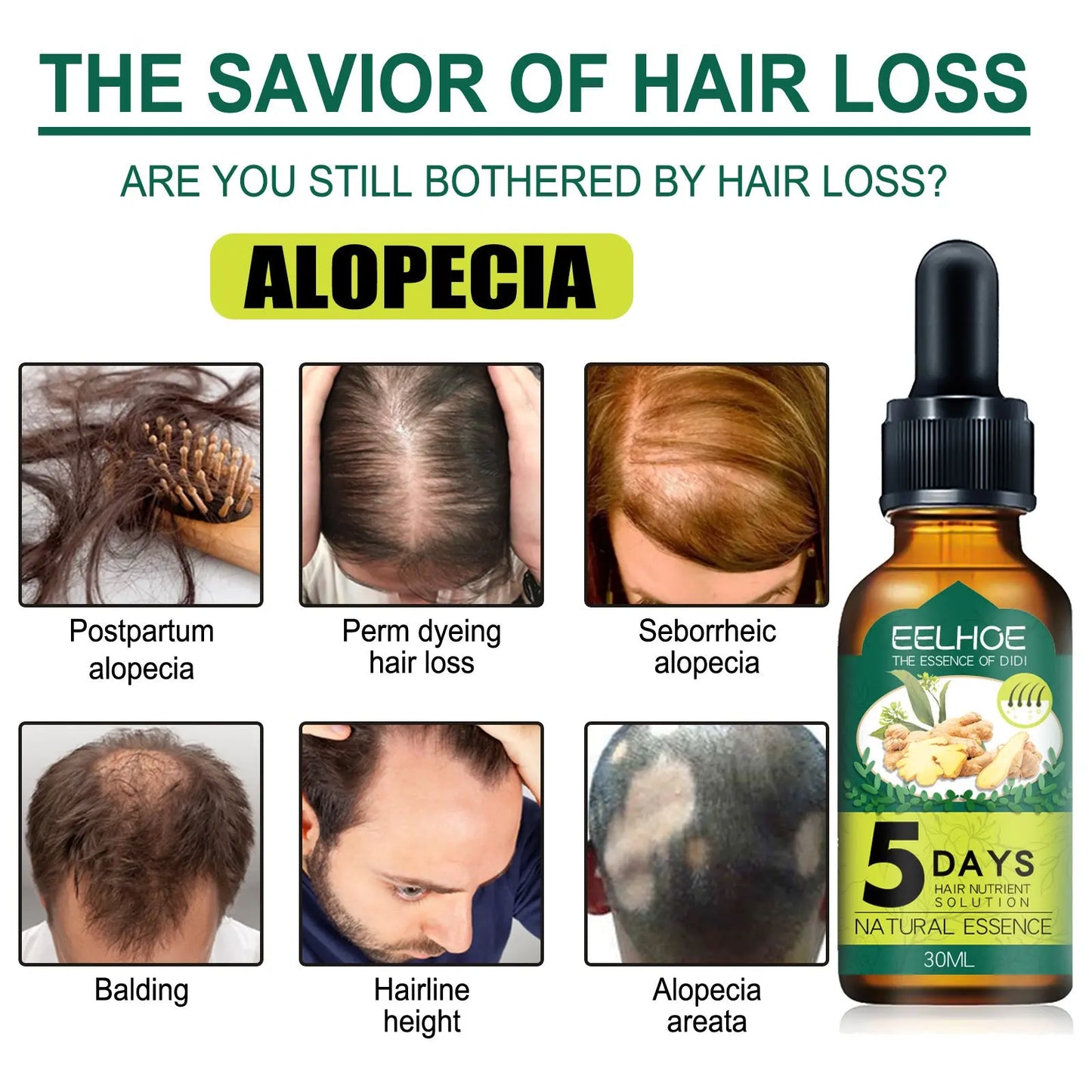 Eelhoe Ginger Hair Essential Oil. Eelhoe Ginger Hair Essential Oil Louisiana Mart