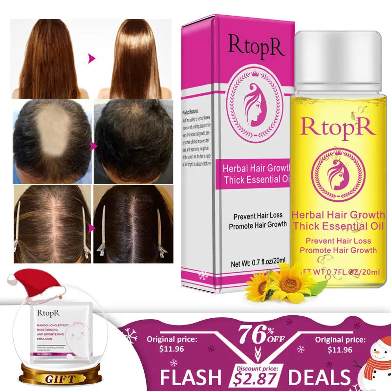Fast Powerful Hair Growth Products Essential Oil Liquid Treatment Preventing Hair Loss Hair Care 20ml Louisiana Mart