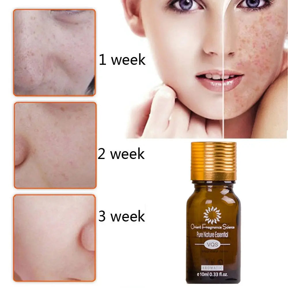Dredge Meridian Skin Care Natural Pure Removal Acne Stretch Marks Scar Removal Essence oil Louisiana Mart
