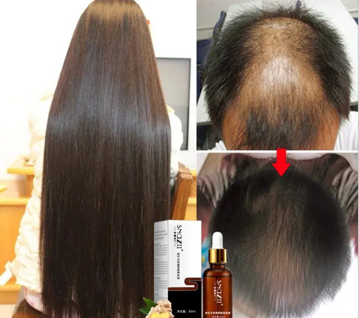 Senna Hair Growth Fluid Louisiana Mart