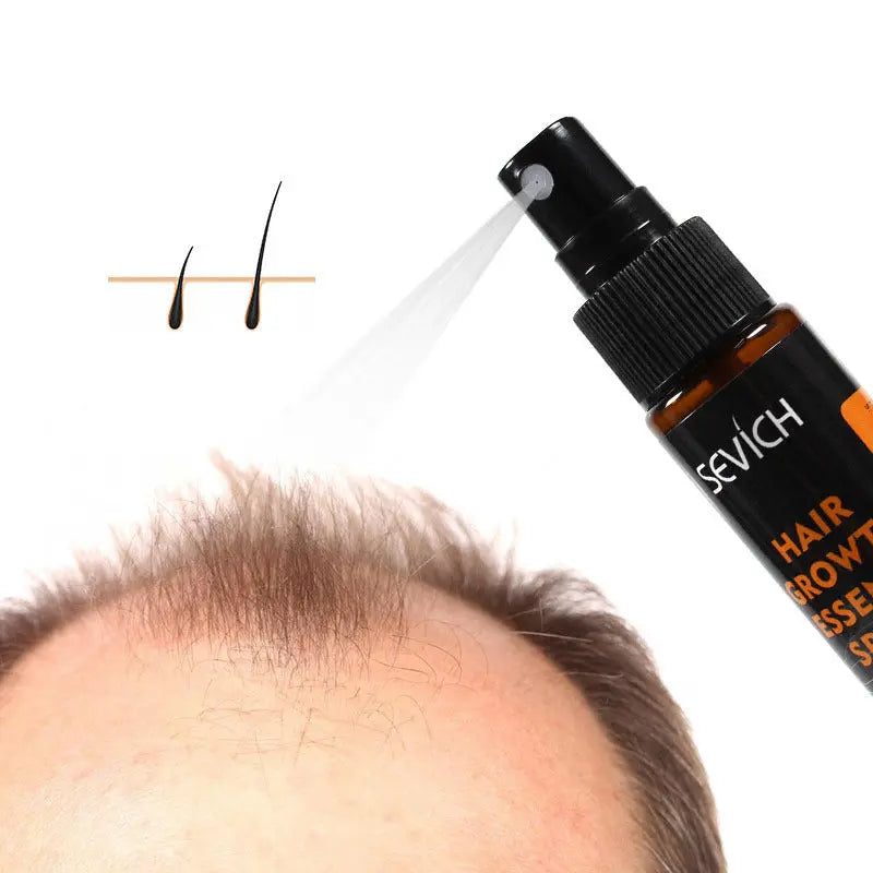 Anti-drop hair lotion tight hair lotion Louisiana Mart