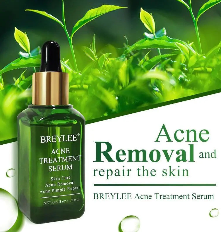 Acne Treatment Serum Facial Repair Oil Louisiana Mart