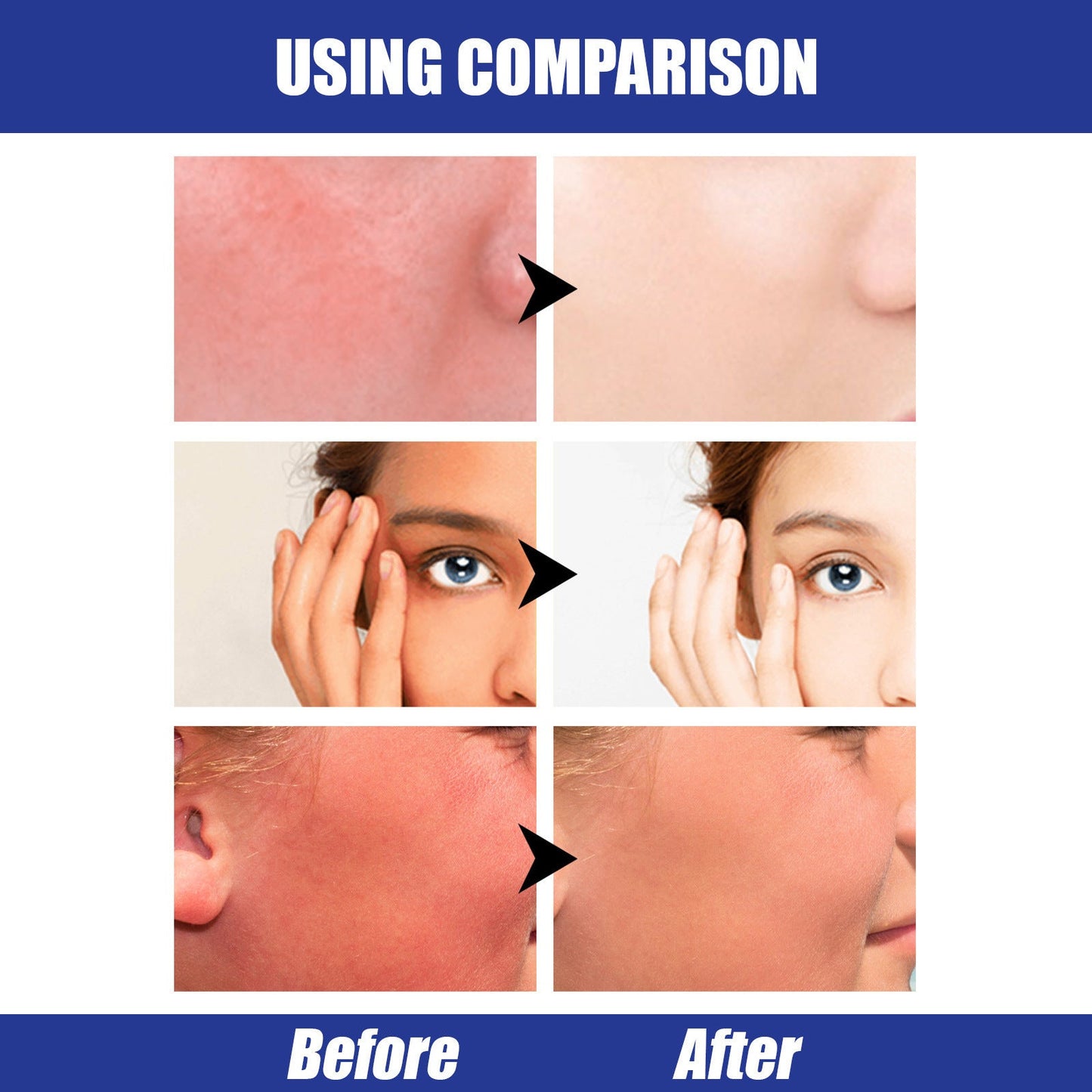Lightweight Freshing And Moistrurizing Waterproof SPF50 Hyaluronic Acid Sun Block Stick Louisiana Mart