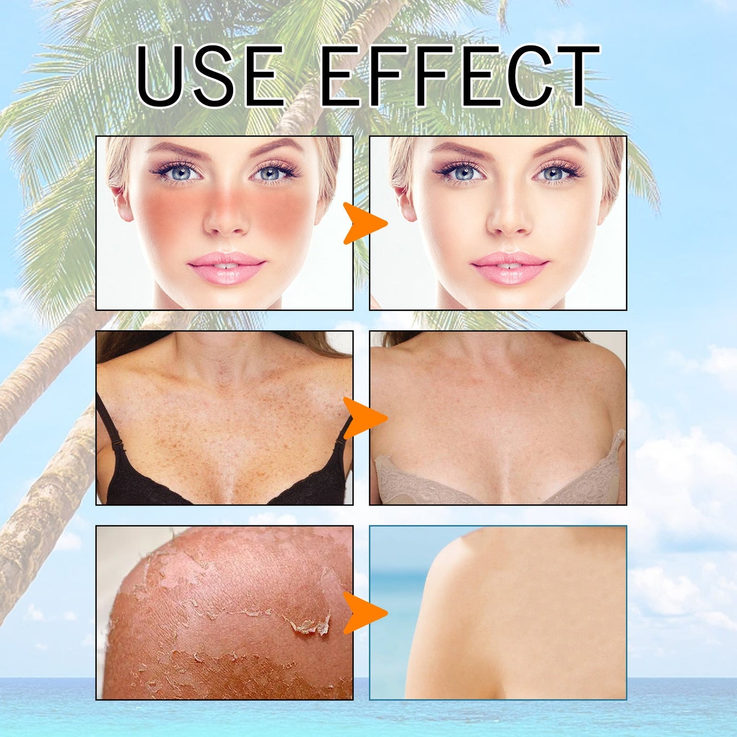 Hyaluronic Acid Moisturizing Protective Gel Summer Outdoor Moisturizing Refreshing Not Oily Resist Ultraviolet Rays Louisiana Mart