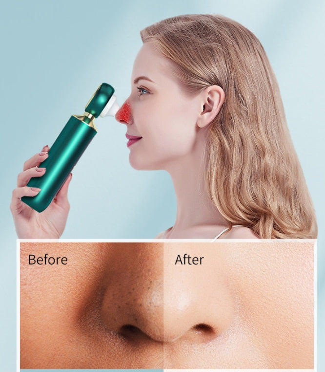 Portable Visual Blackhead Meter Household USB Electric Magnifying Glass Suction Pore Cleaner Blue Light Cleansing To Blackheads Louisiana Mart