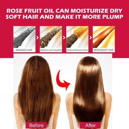 EELHOE Rosehip Facial Oil For Facial And Body Hydration, Nourishing Skin Care, Smooth Hair Care, And Massage Oil Louisiana Mart