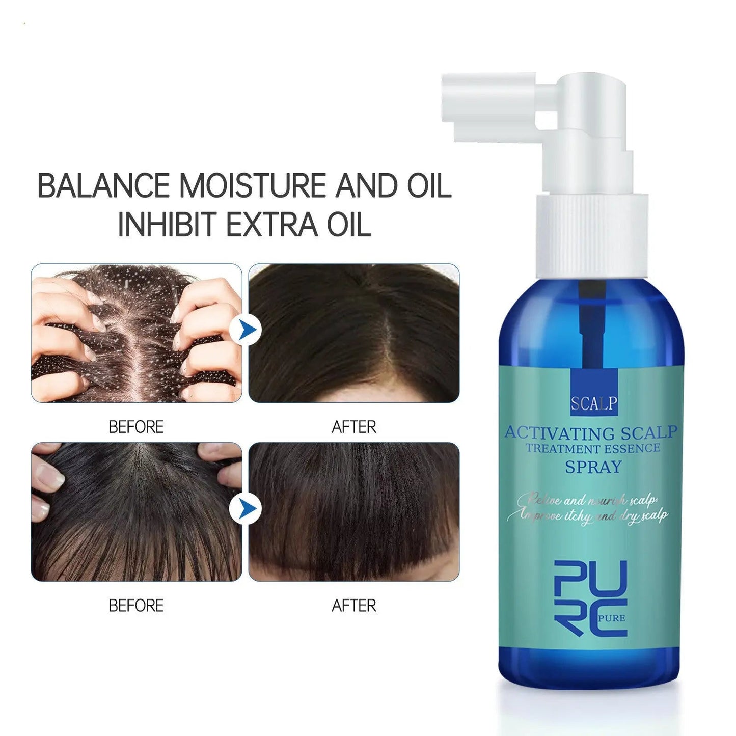 Scalp Care Serum Anti-dandruff Refreshing And Strengthening Mist Louisiana Mart