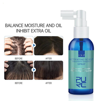 Scalp Care Serum Anti-dandruff Refreshing And Strengthening Mist Louisiana Mart