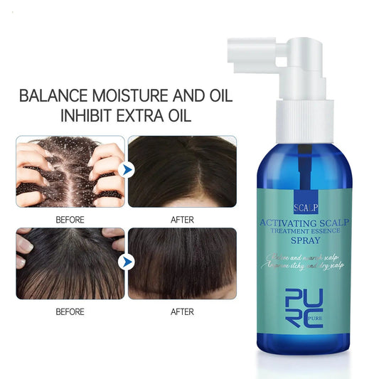 Scalp Care Serum Anti-dandruff Refreshing And Strengthening Mist Louisiana Mart