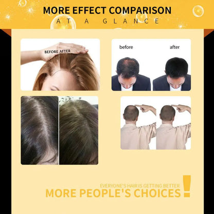 Damaged Hair Repair Women Men's Fast Hair Growth Essence Oil Anti-hair Loss Lotion Louisiana Mart
