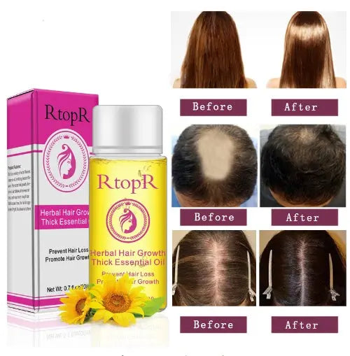 Fast Powerful Hair Growth Products Essential Oil Liquid Treatment Preventing Hair Loss Hair Care 20ml Louisiana Mart