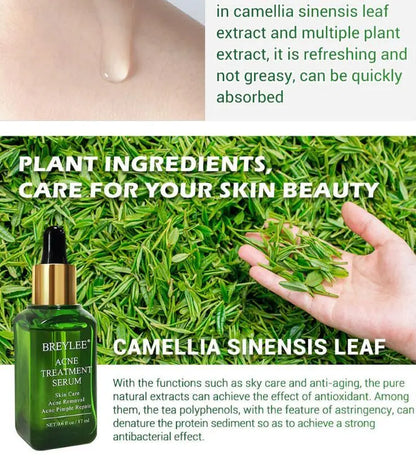 Acne Treatment Serum Facial Repair Oil Louisiana Mart