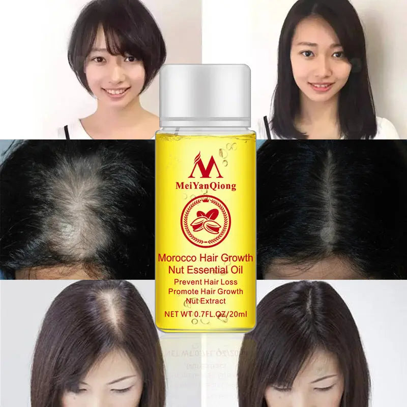 Hair Starch Oil 20ml Improve hair loss Louisiana Mart
