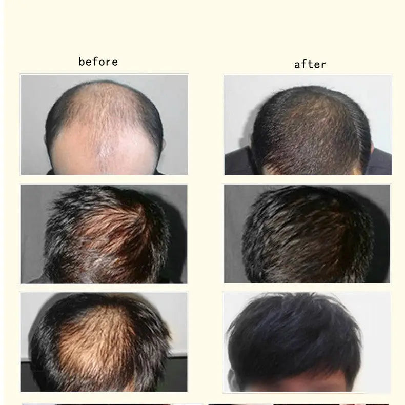 Ginger Anti-hair Loss Hair Maintenance 30ml Louisiana Mart