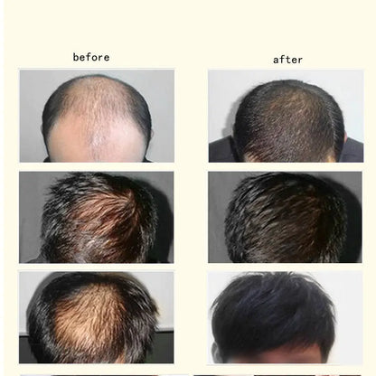 Ginger Anti-hair Loss Hair Maintenance 30ml Louisiana Mart