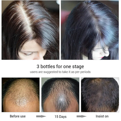 Efero Herbal hair growth fluid Louisiana Mart