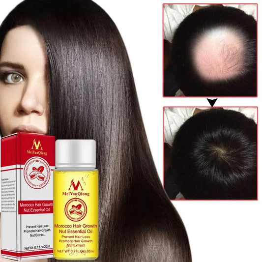 Hair Starch Oil 20ml Improve hair loss Louisiana Mart