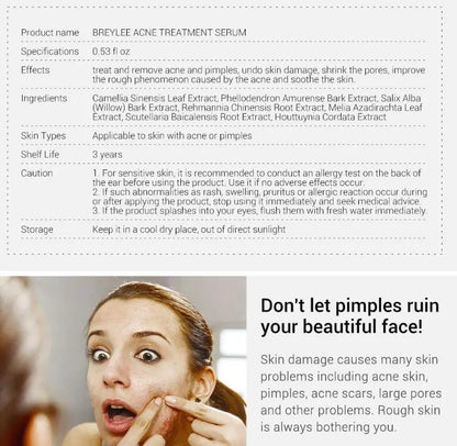 Acne Treatment Serum Facial Repair Oil Louisiana Mart