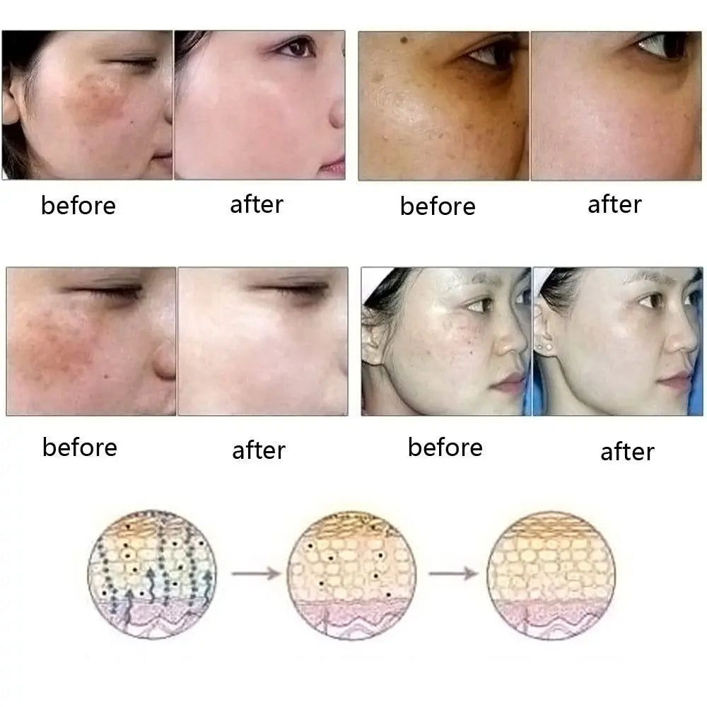 Dredge Meridian Skin Care Natural Pure Removal Acne Stretch Marks Scar Removal Essence oil Louisiana Mart