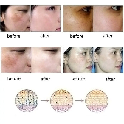 Dredge Meridian Skin Care Natural Pure Removal Acne Stretch Marks Scar Removal Essence oil Louisiana Mart