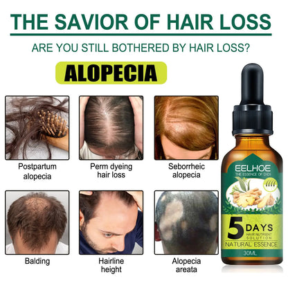 Eelhoe Ginger Hair Essential Oil. Eelhoe Ginger Hair Essential Oil Louisiana Mart