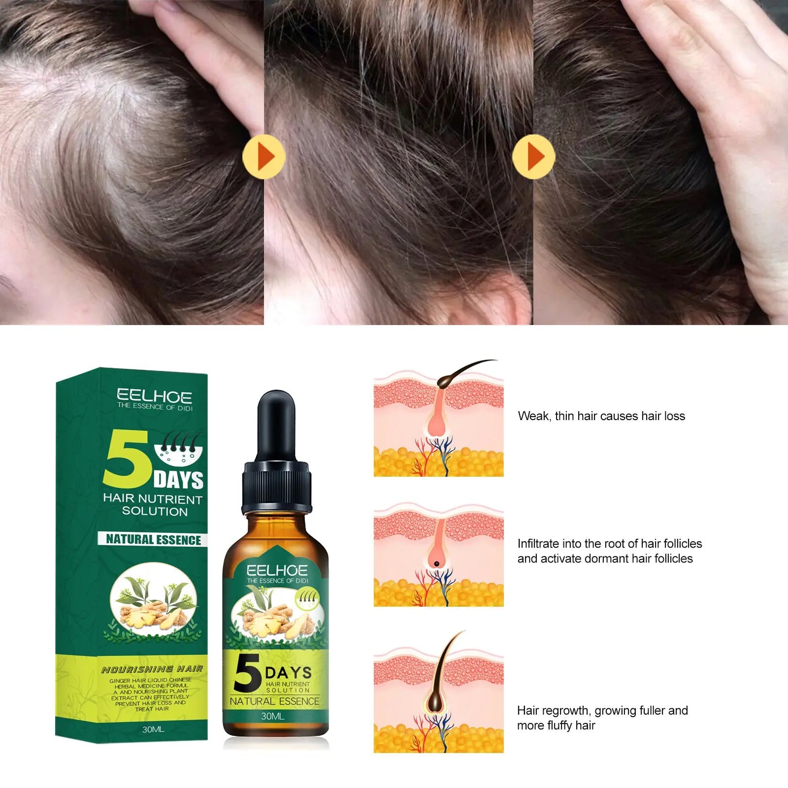 Eelhoe Ginger Hair Essential Oil. Eelhoe Ginger Hair Essential Oil Louisiana Mart