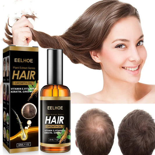 Ginger Repair Hair Follicle Soft Moisturizing And Nourishing Essential Oil 30ml Louisiana Mart