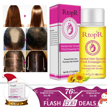 Fast Powerful Hair Growth Products Essential Oil Liquid Treatment Preventing Hair Loss Hair Care 20ml Louisiana Mart