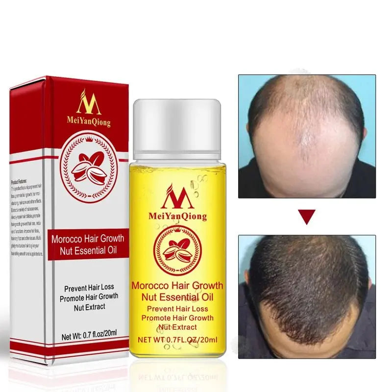 Hair Starch Oil 20ml Improve hair loss Louisiana Mart