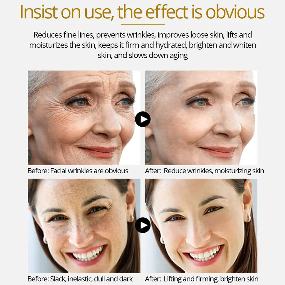4K Gold three-in-one effect of skin tightening, whitening and wrinkle removal Louisiana Mart