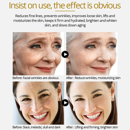 4K Gold three-in-one effect of skin tightening, whitening and wrinkle removal Louisiana Mart