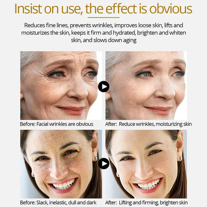 4K Gold three-in-one effect of skin tightening, whitening and wrinkle removal Louisiana Mart