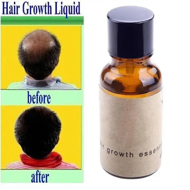 Hair growth liquid Louisiana Mart
