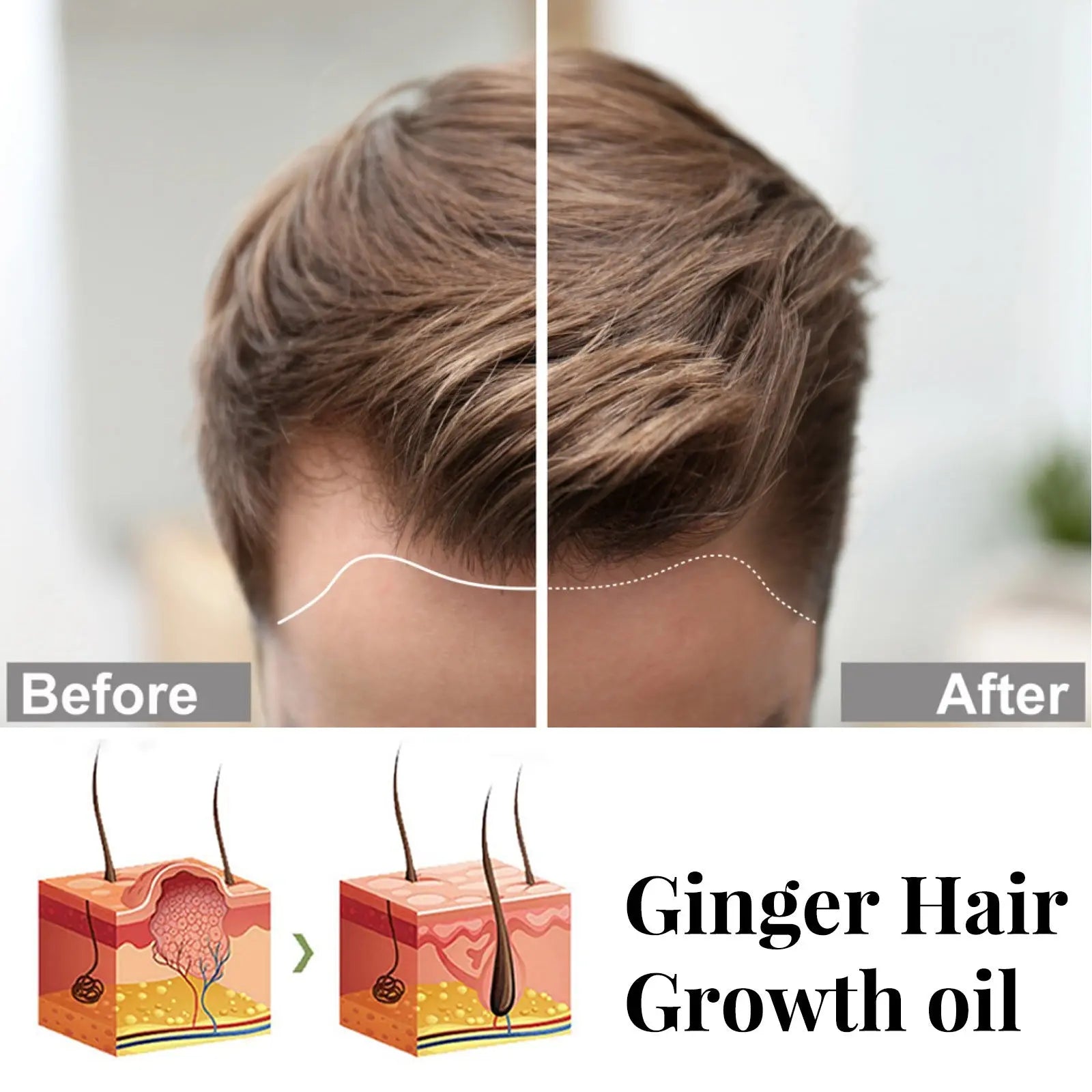 Ginger Repair Hair Follicle Soft Moisturizing And Nourishing Essential Oil 30ml Louisiana Mart