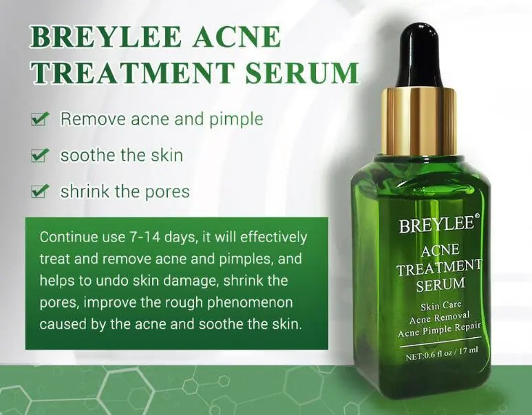 Acne Treatment Serum Facial Repair Oil Louisiana Mart