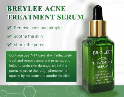 Acne Treatment Serum Facial Repair Oil Louisiana Mart