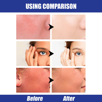 Lightweight Freshing And Moistrurizing Waterproof SPF50 Hyaluronic Acid Sun Block Stick Louisiana Mart