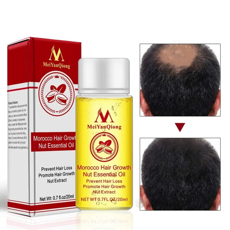 Hair Starch Oil 20ml Improve hair loss Louisiana Mart