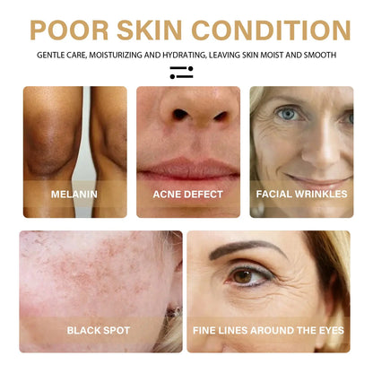 Turmeric Oil 100% Pure & Natural Dark Spot Correction Face Care Spot Moisturizing And Repairing Skin Tone Serum Louisiana Mart