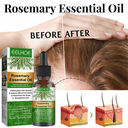 Rosemary Anti-Breakage Nourishing Hair Care Oil Louisiana Mart