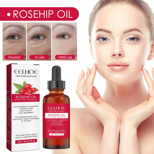 EELHOE Rosehip Facial Oil For Facial And Body Hydration, Nourishing Skin Care, Smooth Hair Care, And Massage Oil Louisiana Mart